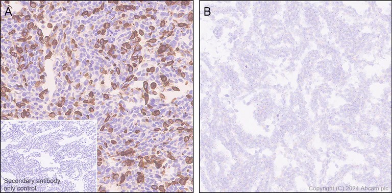 Immunohistochemistry (Formalin/PFA-fixed paraffin-embedded sections) - Anti-ASIC3 antibody [RM2049] (AB317460)