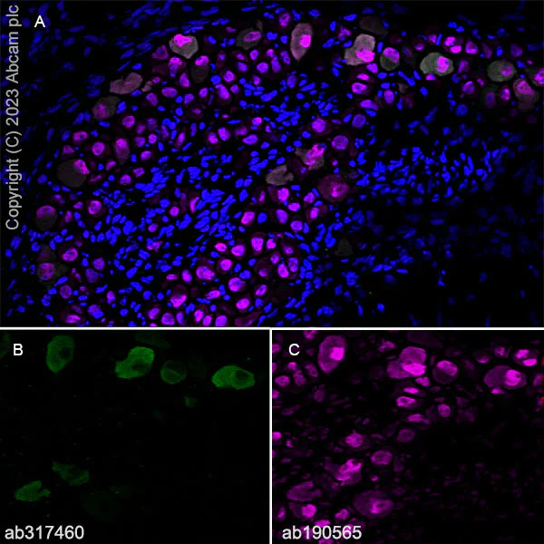 Immunohistochemistry (Frozen sections) - Anti-ASIC3 antibody [RM2049] (AB317460)
