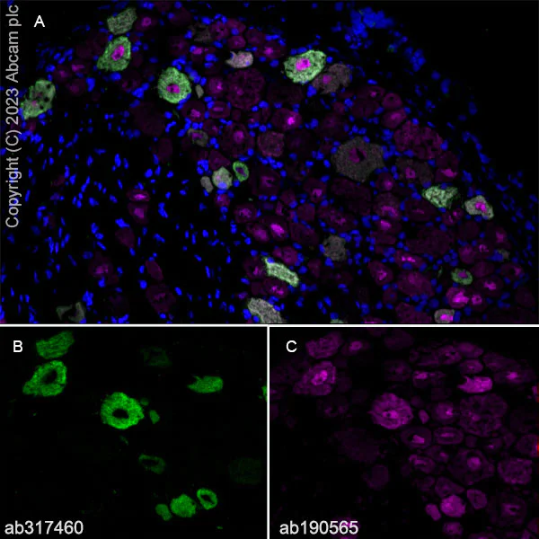Immunohistochemistry (Frozen sections) - Anti-ASIC3 antibody [RM2049] (AB317460)