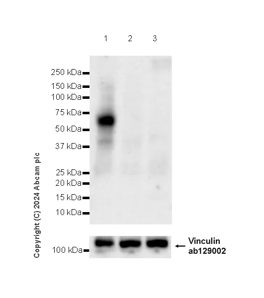 Western blot - Anti-ASIC3 antibody [RM2049] (AB317460)