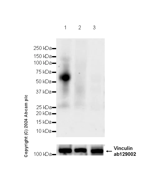 Western blot - Anti-ASIC3 antibody [RM2049] (AB317460)