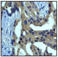 Immunohistochemistry (Formalin/PFA-fixed paraffin-embedded sections) - Anti-ASK1 antibody [EP553Y] (AB45178)