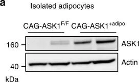 Western blot - Anti-ASK1 antibody [EP553Y] (AB45178)