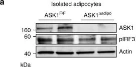 Western blot - Anti-ASK1 antibody [EP553Y] (AB45178)