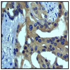 Immunohistochemistry (Formalin/PFA-fixed paraffin-embedded sections) - Anti-ASK1 antibody [EP553Y] - BSA and Azide free (AB177030)