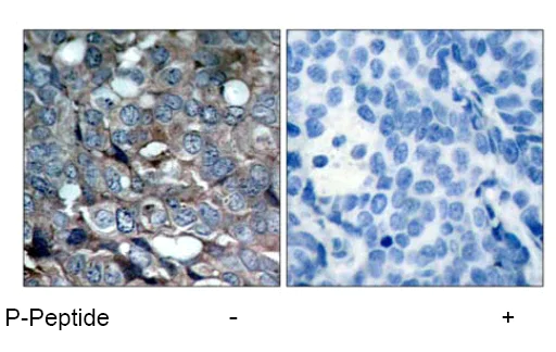 Immunohistochemistry (Formalin/PFA-fixed paraffin-embedded sections) - Anti-ASK1 (phospho S83) antibody (AB47304)
