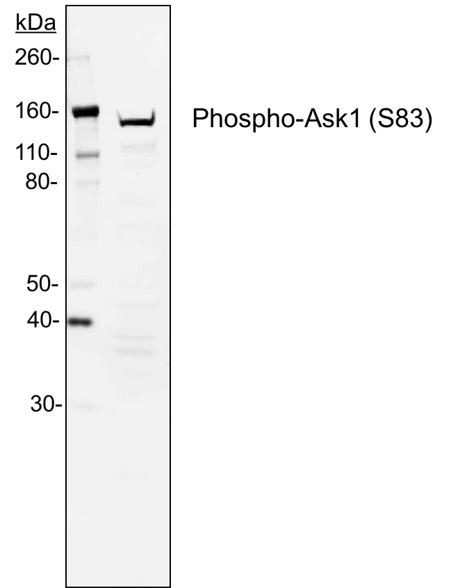 Western blot - Anti-ASK1 (phospho S83) antibody [Ask1S83-G4] (AB278547)