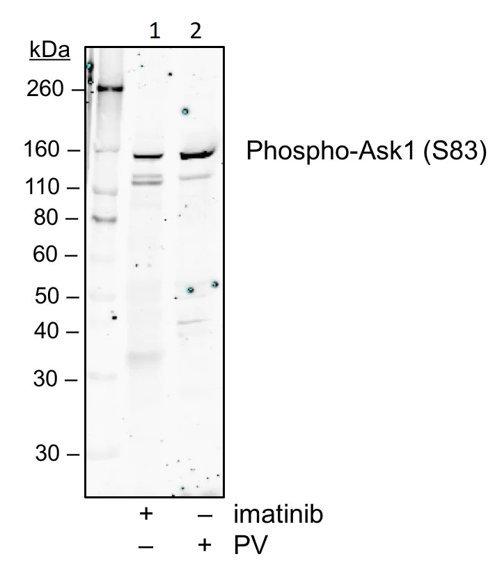 Western blot - Anti-ASK1 (phospho S83) antibody [Ask1S83-G4] (AB278547)