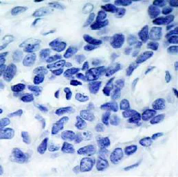 Immunohistochemistry (Formalin/PFA-fixed paraffin-embedded sections) - Anti-ASK1 (phospho S966) antibody (AB39402)