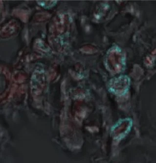 Immunohistochemistry (Formalin/PFA-fixed paraffin-embedded sections) - Anti-ASN antibody (AB243206)