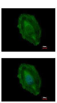 Immunocytochemistry/ Immunofluorescence - Anti-ASPA antibody (AB154503)