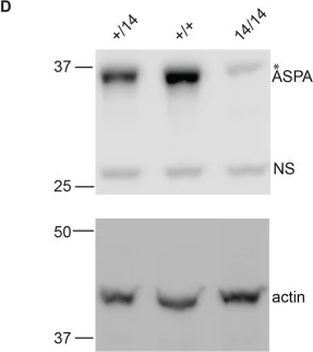 Western blot - Anti-ASPA antibody (AB154503)