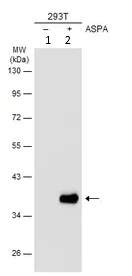 Western blot - Anti-ASPA antibody (AB154503)