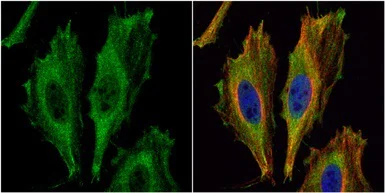 Immunocytochemistry/ Immunofluorescence - Anti-ASPA antibody (AB97454)