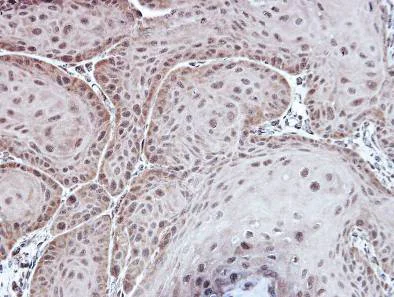 Anti-ASPA antibody (ab97454) | Abcam