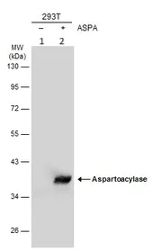 Western blot - Anti-ASPA antibody (AB97454)