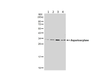 Western blot - Anti-ASPA antibody (AB97454)