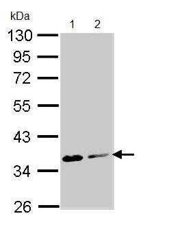 Western blot - Anti-ASPA antibody (AB97454), expandable thumbnail