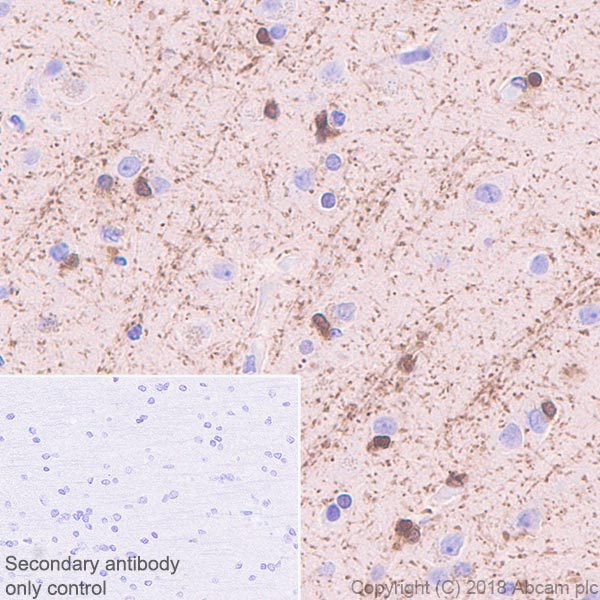 Immunohistochemistry (Formalin/PFA-fixed paraffin-embedded sections) - Anti-ASPA antibody [EPR22072] (ab223269), expandable thumbnail