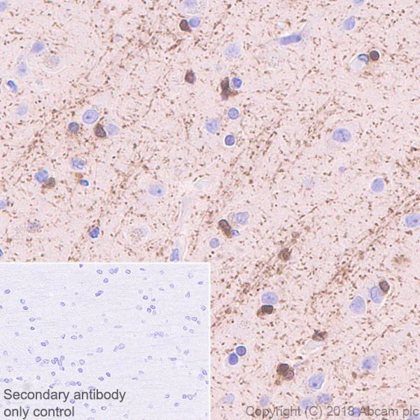Immunohistochemistry (Formalin/PFA-fixed paraffin-embedded sections) - Anti-ASPA antibody [EPR22072] (AB223269)