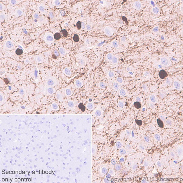 Immunohistochemistry (Formalin/PFA-fixed paraffin-embedded sections) - Anti-ASPA antibody [EPR22072] (AB223269), expandable thumbnail