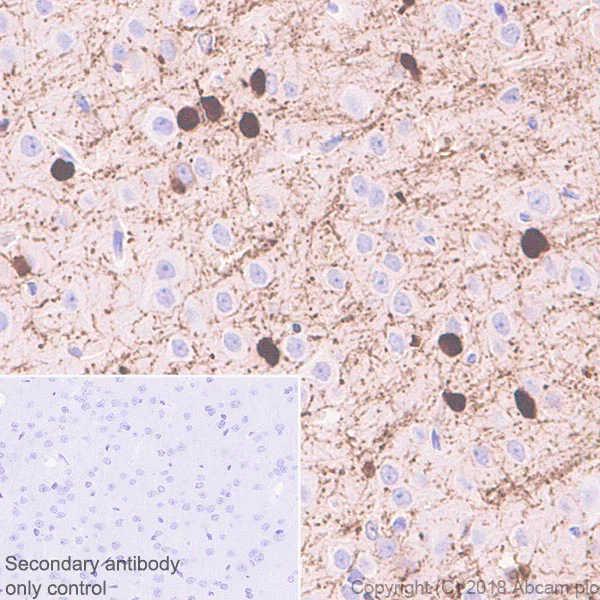 Immunohistochemistry (Formalin/PFA-fixed paraffin-embedded sections) - Anti-ASPA antibody [EPR22072] (AB223269)