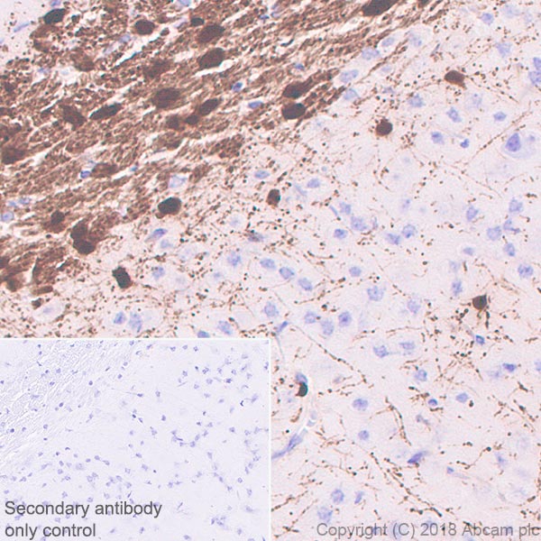 Immunohistochemistry (Formalin/PFA-fixed paraffin-embedded sections) - Anti-ASPA antibody [EPR22072] (ab223269), expandable thumbnail