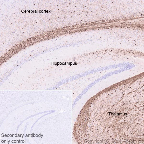 Immunohistochemistry (Formalin/PFA-fixed paraffin-embedded sections) - Anti-ASPA antibody [EPR22072] (AB223269)