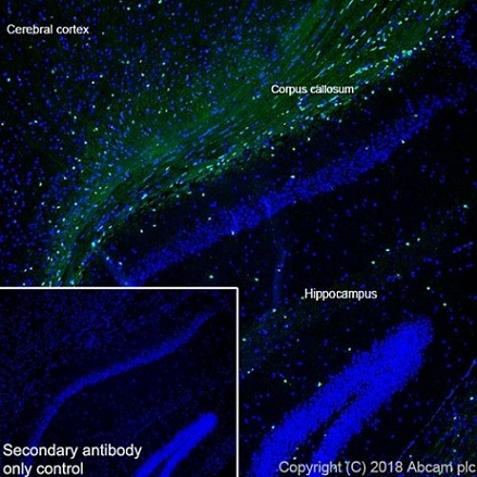 Immunohistochemistry (Frozen sections) - Anti-ASPA antibody [EPR22072] (ab223269), expandable thumbnail
