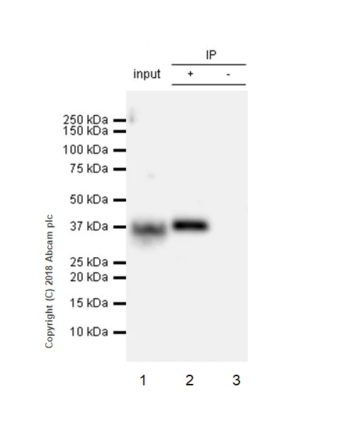 Immunoprecipitation - Anti-ASPA antibody [EPR22072] (AB223269)