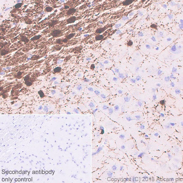 Immunohistochemistry (Formalin/PFA-fixed paraffin-embedded sections) - Anti-ASPA antibody [EPR22072] - BSA and Azide free (AB239522)