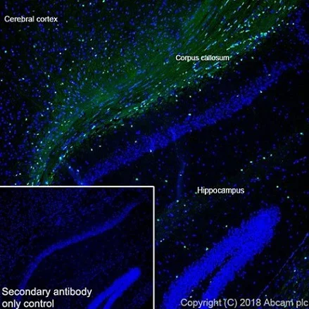Immunohistochemistry (Frozen sections) - Anti-ASPA antibody [EPR22072] - BSA and Azide free (AB239522)