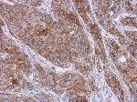 Immunohistochemistry (Formalin/PFA-fixed paraffin-embedded sections) - Anti-Asparagine synthetase antibody (AB126254)