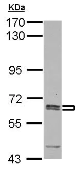 Western blot - Anti-Asparagine synthetase antibody (AB126254)