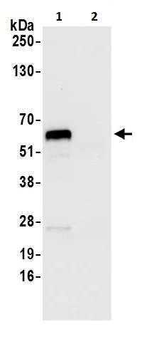 Immunoprecipitation - Anti-Asparagine synthetase antibody (AB226413)