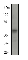 Western blot - Anti-Asparagine synthetase antibody [EP282Y] (AB40850), expandable thumbnail