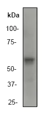 Western blot - Anti-Asparagine synthetase antibody [EP282Y] (AB40850)
