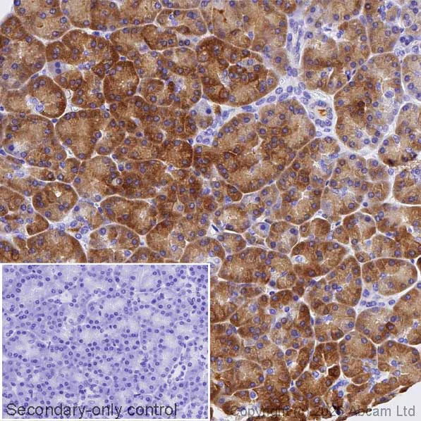 Immunohistochemistry (Formalin/PFA-fixed paraffin-embedded sections) - Anti-Asparagine synthetase antibody [EPR29731-24] (AB326953)