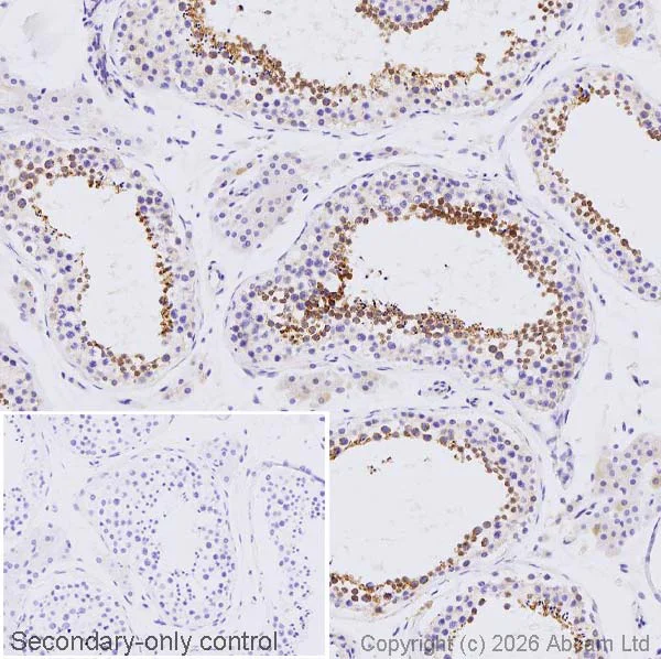 Immunohistochemistry (Formalin/PFA-fixed paraffin-embedded sections) - Anti-Asparagine synthetase antibody [EPR29731-24] (AB326953)