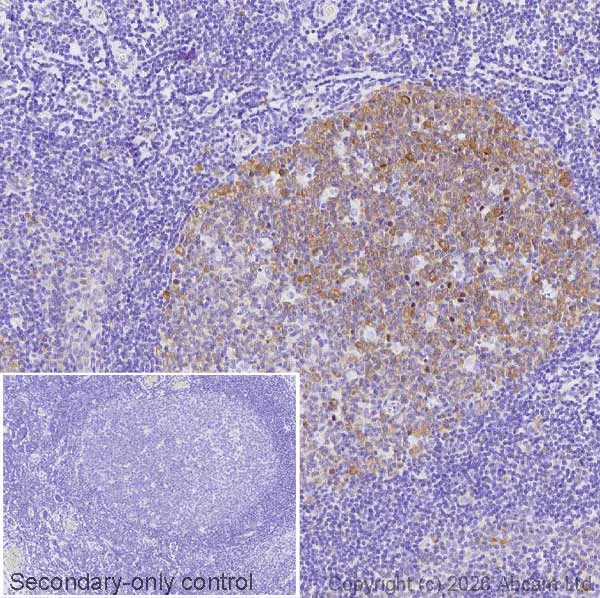 Immunohistochemistry (Formalin/PFA-fixed paraffin-embedded sections) - Anti-Asparagine synthetase antibody [EPR29731-24] (AB326953)