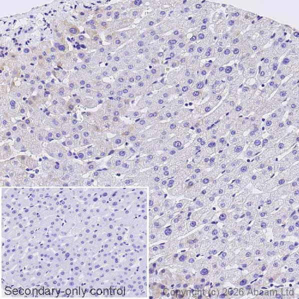 Immunohistochemistry (Formalin/PFA-fixed paraffin-embedded sections) - Anti-Asparagine synthetase antibody [EPR29731-24] (AB326953)