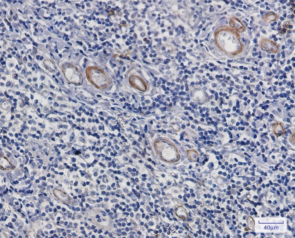 Immunohistochemistry (Formalin/PFA-fixed paraffin-embedded sections) - Anti-Asparagine synthetase Antibody [S05-9E5] (AB317374), expandable thumbnail