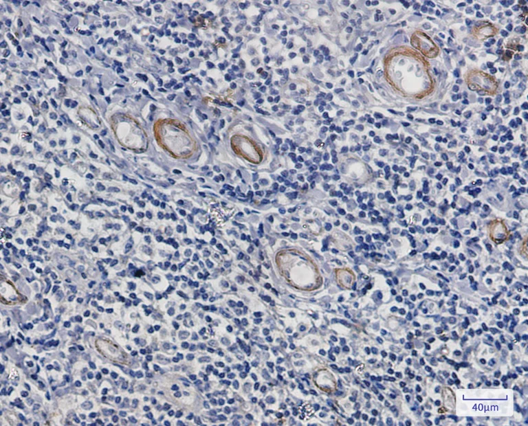 Immunohistochemistry (Formalin/PFA-fixed paraffin-embedded sections) - Anti-Asparagine synthetase Antibody [S05-9E5] (AB317374)