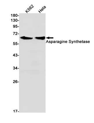 Western blot - Anti-Asparagine synthetase Antibody [S05-9E5] (AB317374)