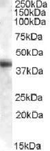 Western blot - Anti-Aspartate Aminotransferase antibody (AB85857)