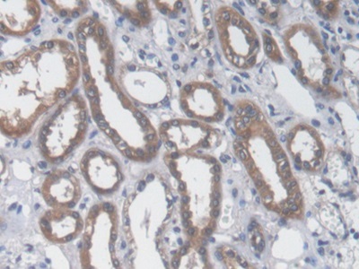 Immunohistochemistry (Formalin/PFA-fixed paraffin-embedded sections) - Anti-Aspartate Aminotransferase antibody [C1] (AB239487)