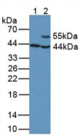 Western blot - Anti-Aspartate Aminotransferase antibody [C1] (AB239487)