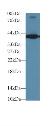 Western blot - Anti-Aspartate Aminotransferase antibody [C1] (AB239487)