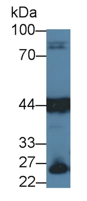 Western blot - Anti-Aspartate Aminotransferase antibody [C1] (AB239487)