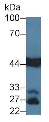 Western blot - Anti-Aspartate Aminotransferase antibody [C1] (AB239487)